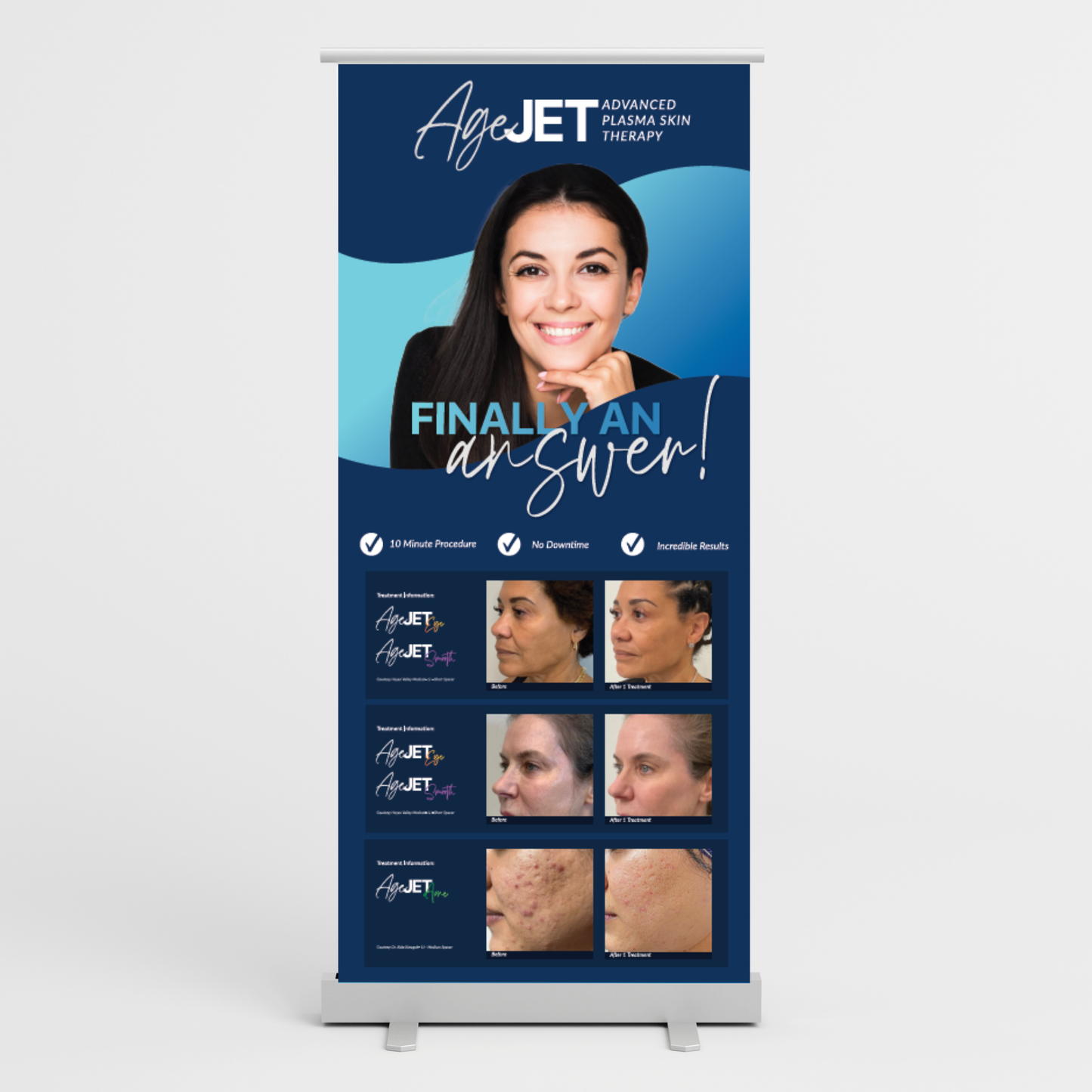 AgeJET Bannerstand